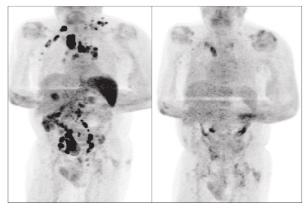 Foto: Reprodução/British Journal of Haematology